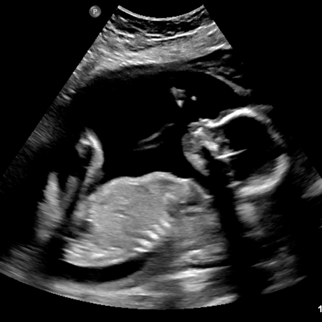Photo shared by Amanda for their Babylist baby registry.
