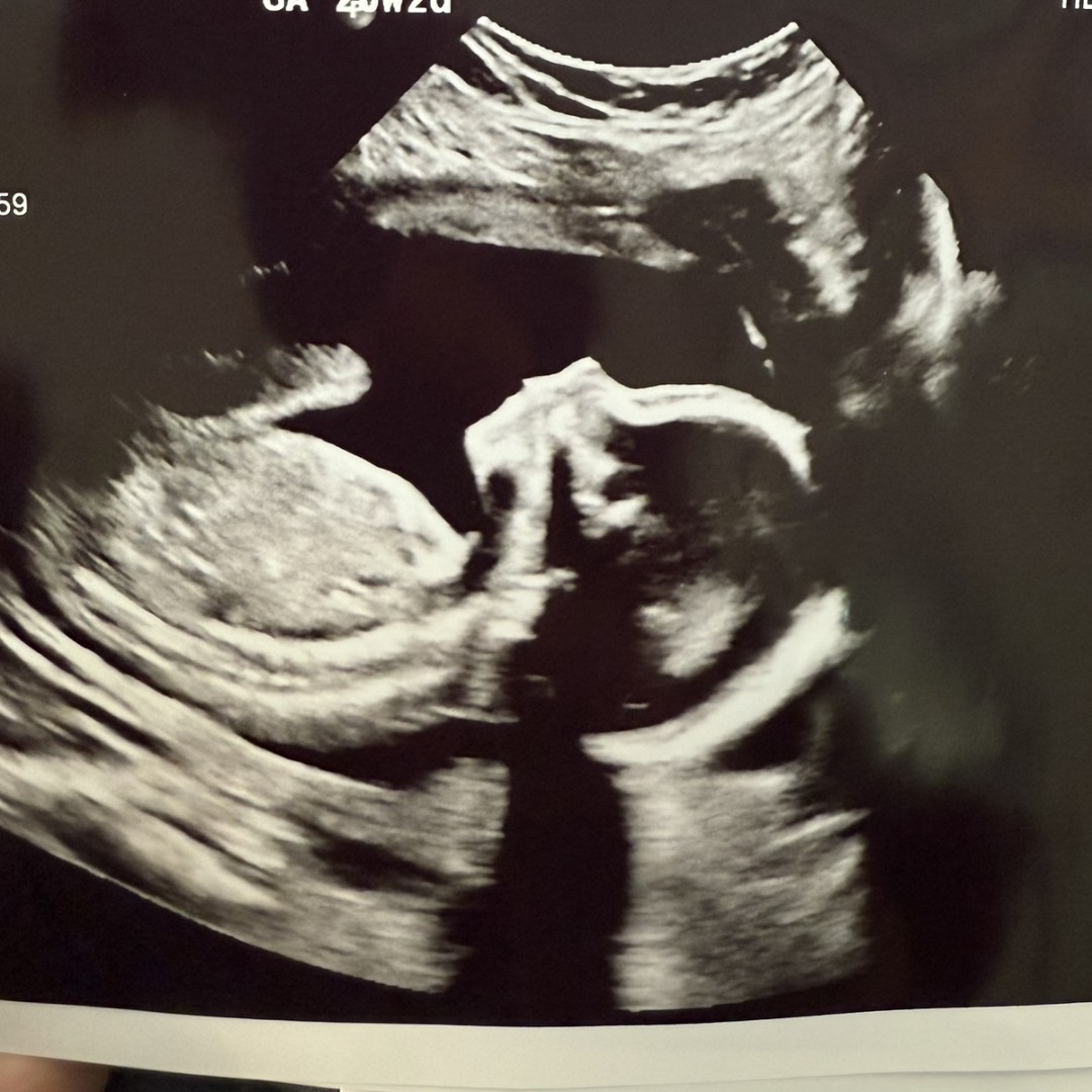 Photo shared by Maddie for their Babylist baby registry.