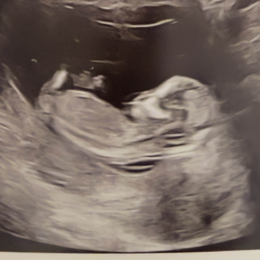 Photo shared by Alexandra Jo for their Babylist baby registry.