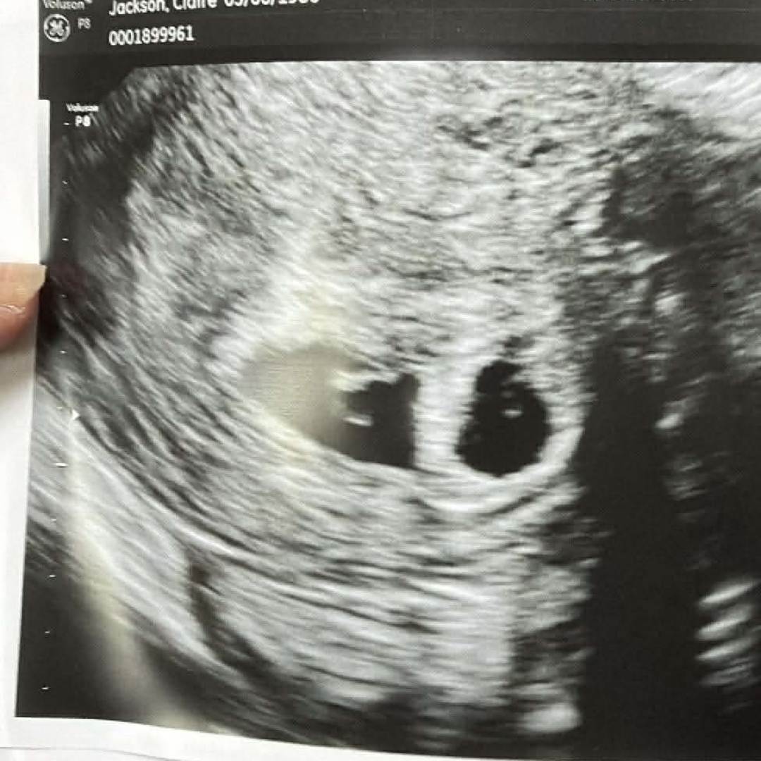 Photo shared by Claire for their Babylist baby registry.