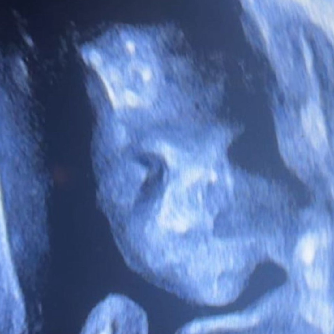 Photo shared by Clara for their Babylist baby registry.