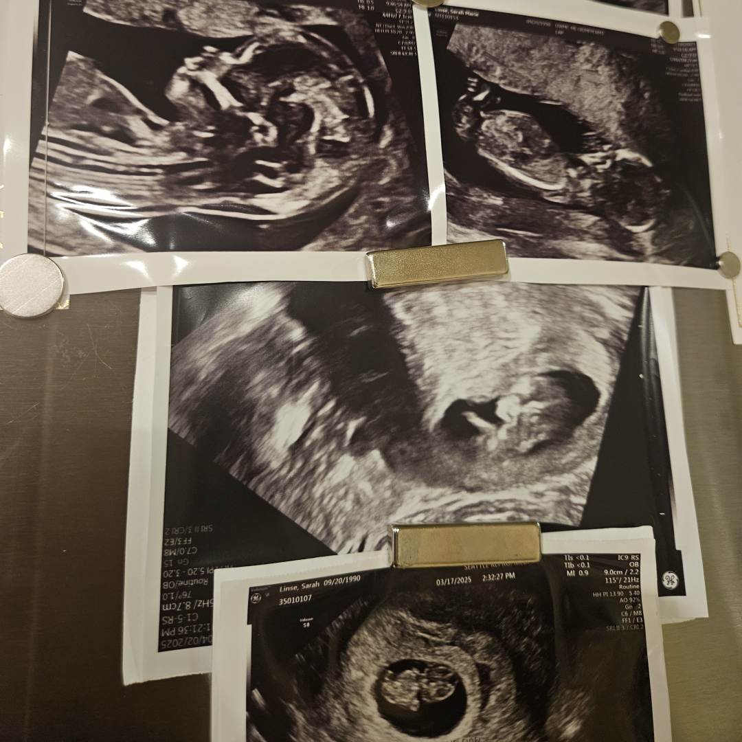 Photo shared by Sarah for their Babylist baby registry.