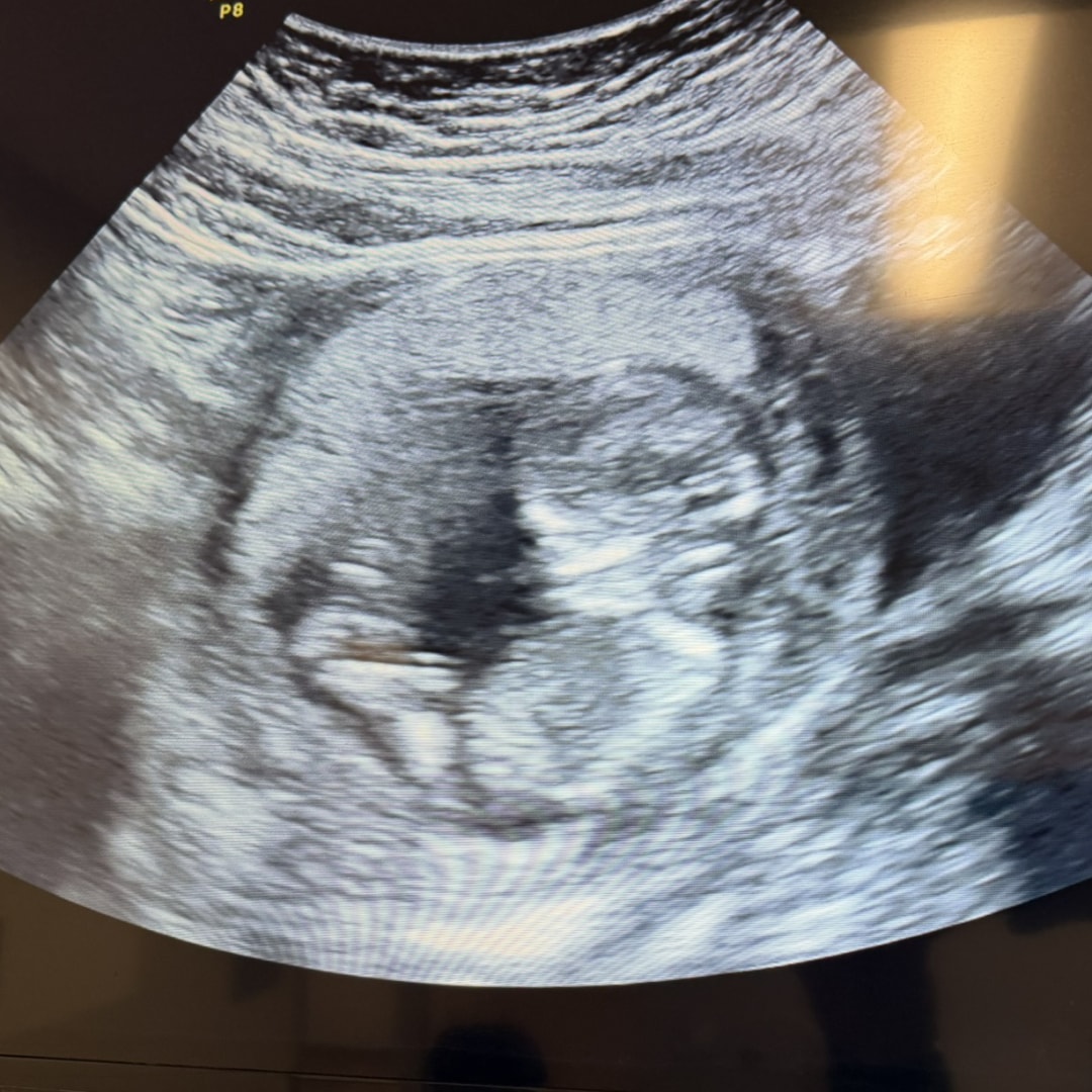 Photo shared by Irene Heder for their Babylist baby registry.
