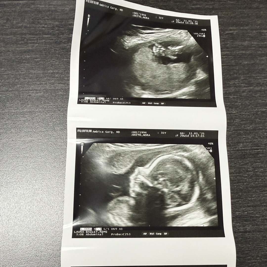 Photo shared by Nora for their Babylist baby registry.