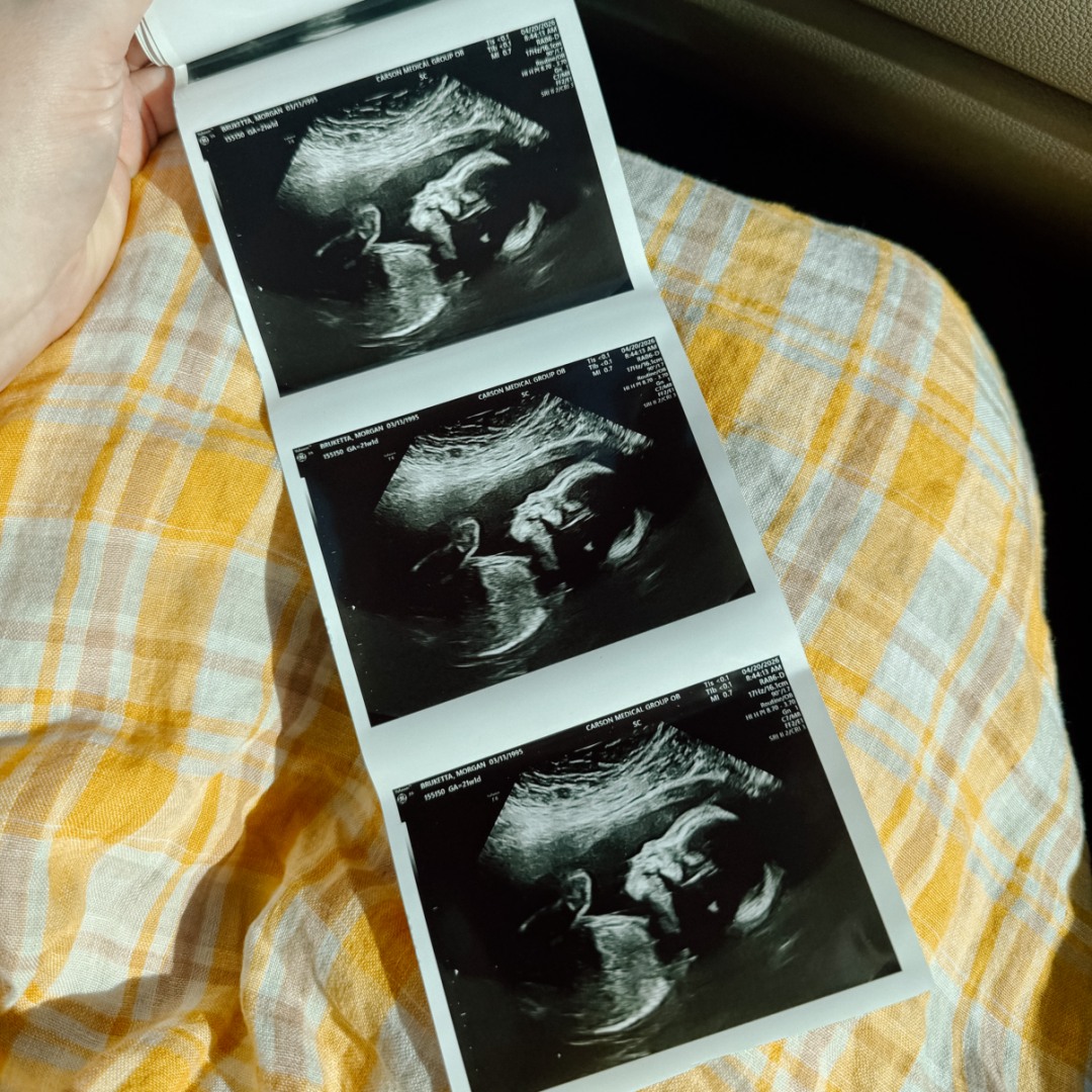 Photo shared by Morgan for their Babylist baby registry.