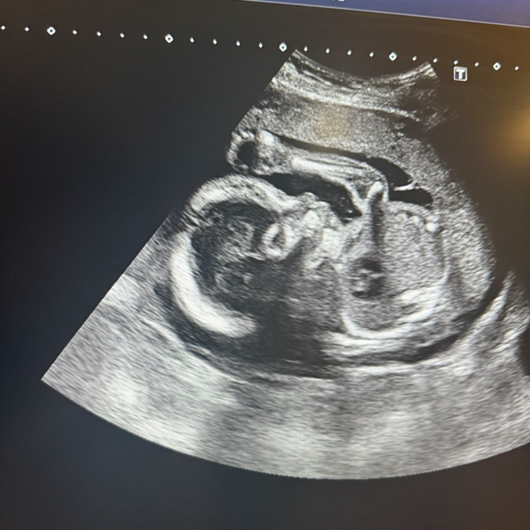 Photo shared by Kelly for their Babylist baby registry.