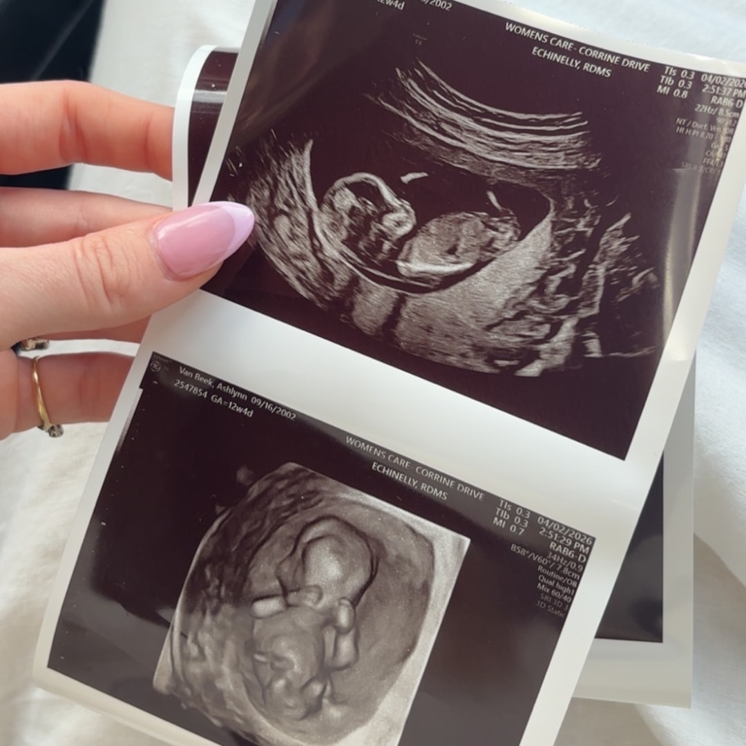 Photo shared by Ashlynn for their Babylist baby registry.