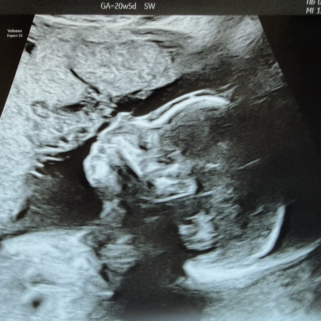 Photo shared by Aidan for their Babylist baby registry.