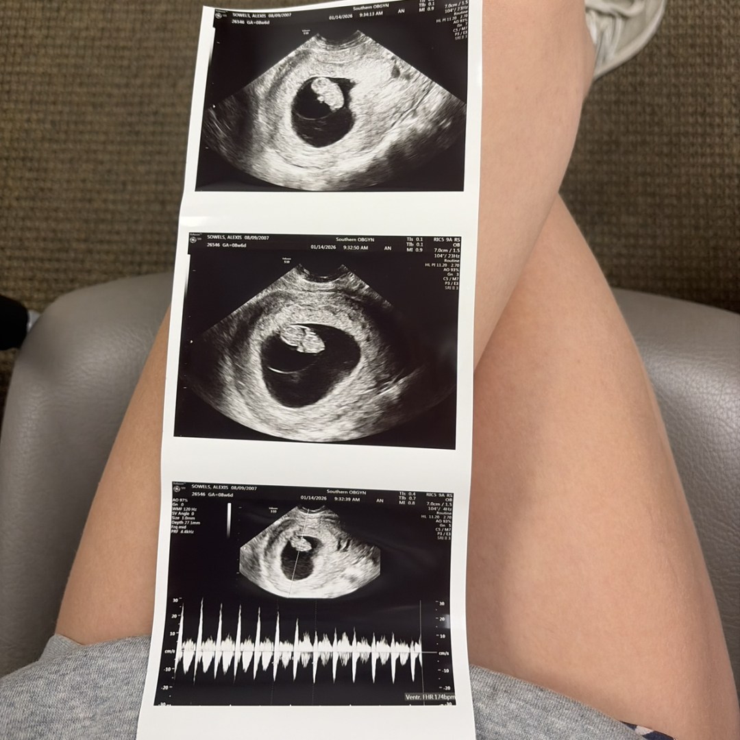 Photo shared by Lexi for their Babylist baby registry.