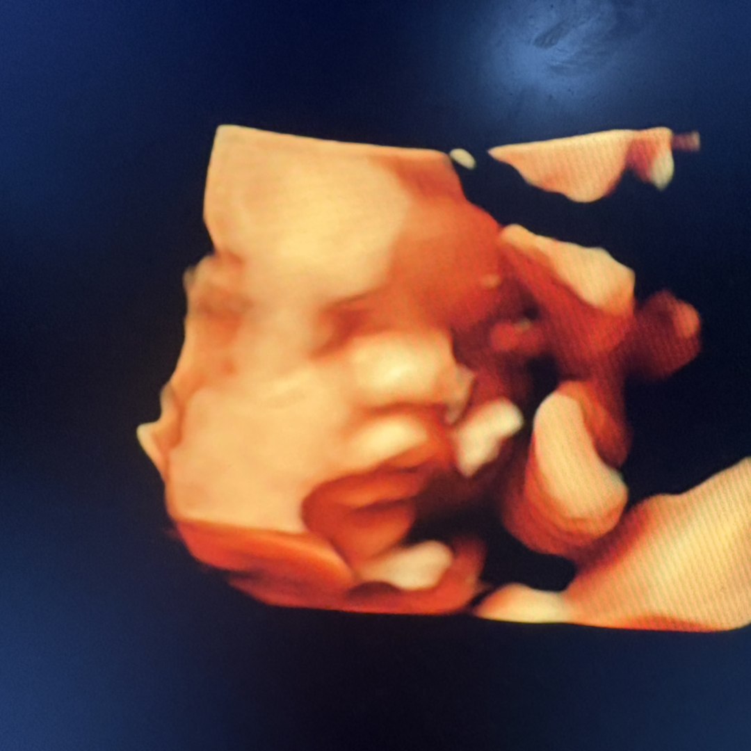 Photo shared by Aviana for their Babylist baby registry.