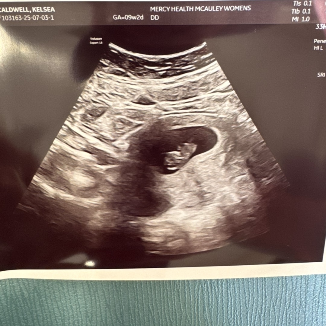 Photo shared by Kelsea for their Babylist baby registry.