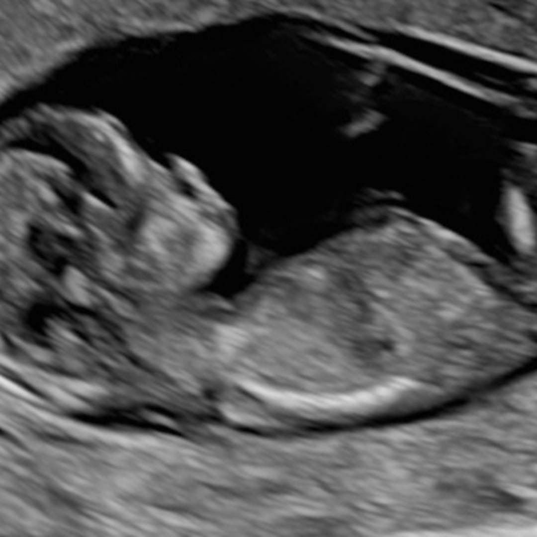 Photo shared by Catherine von Hagn & for their Babylist baby registry.