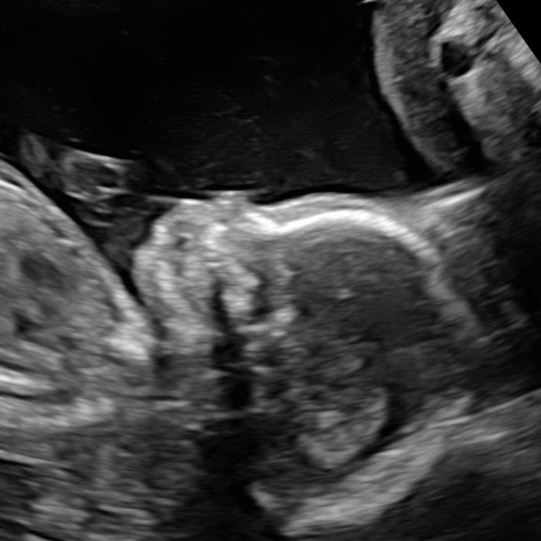 Photo shared by Grace for their Babylist baby registry.