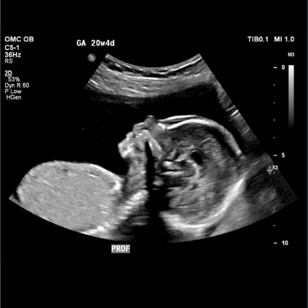 Photo shared by Elizabeth for their Babylist baby registry.