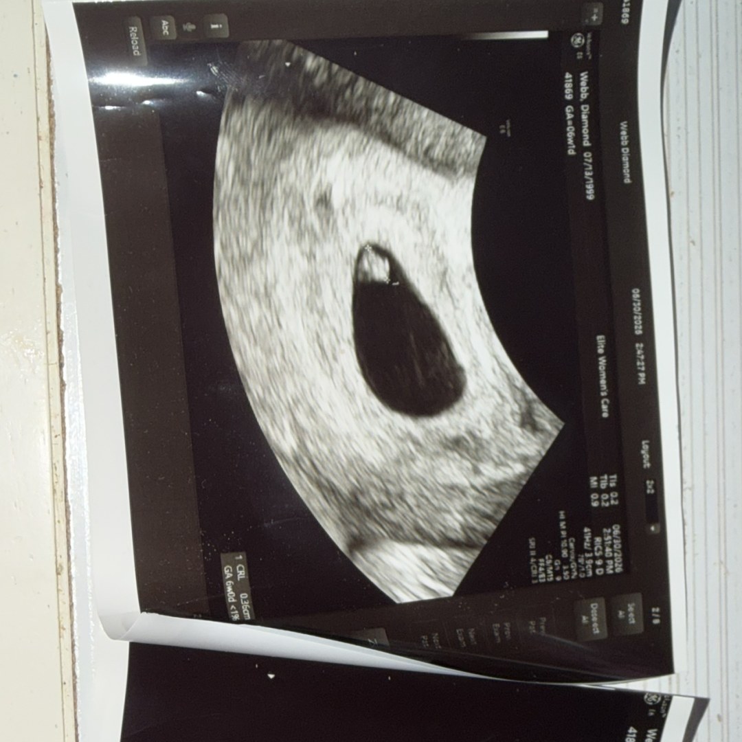 Photo shared by Diamond for their Babylist baby registry.