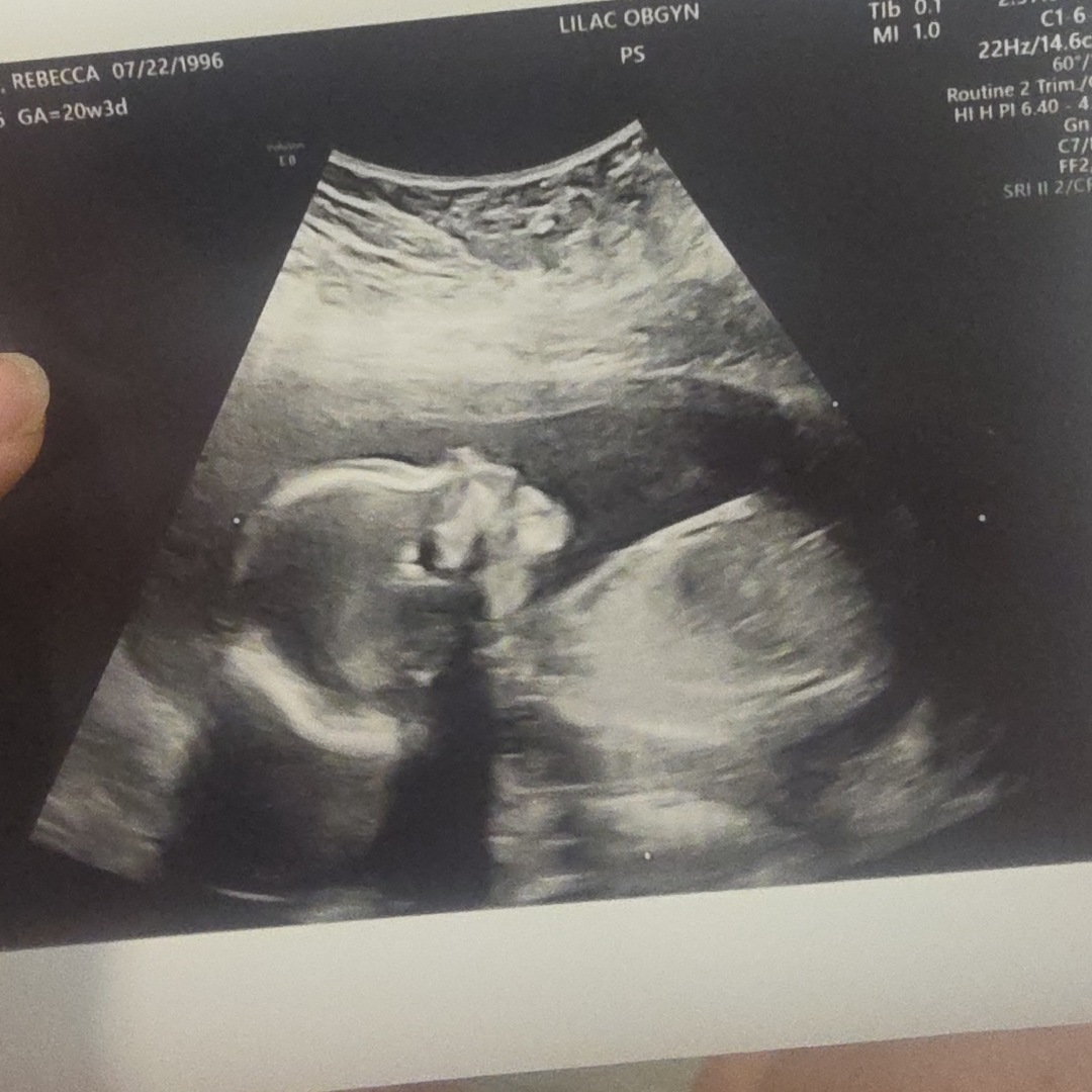 Photo shared by Rebecca for their Babylist baby registry.