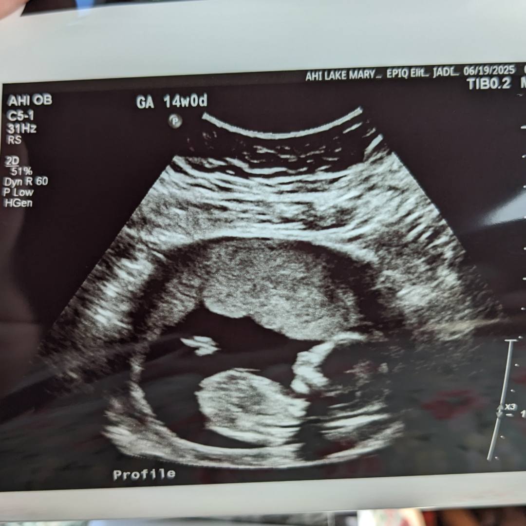 Photo shared by Karla for their Babylist baby registry.