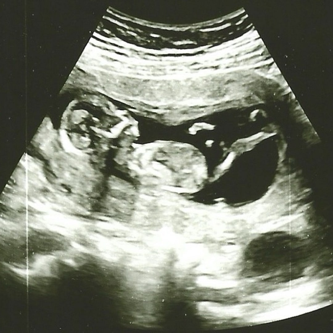 Photo shared by Rita (Rich) for their Babylist baby registry.