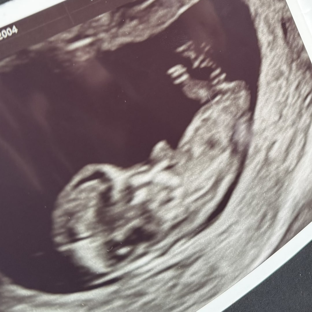 Photo shared by Haylea for their Babylist baby registry.