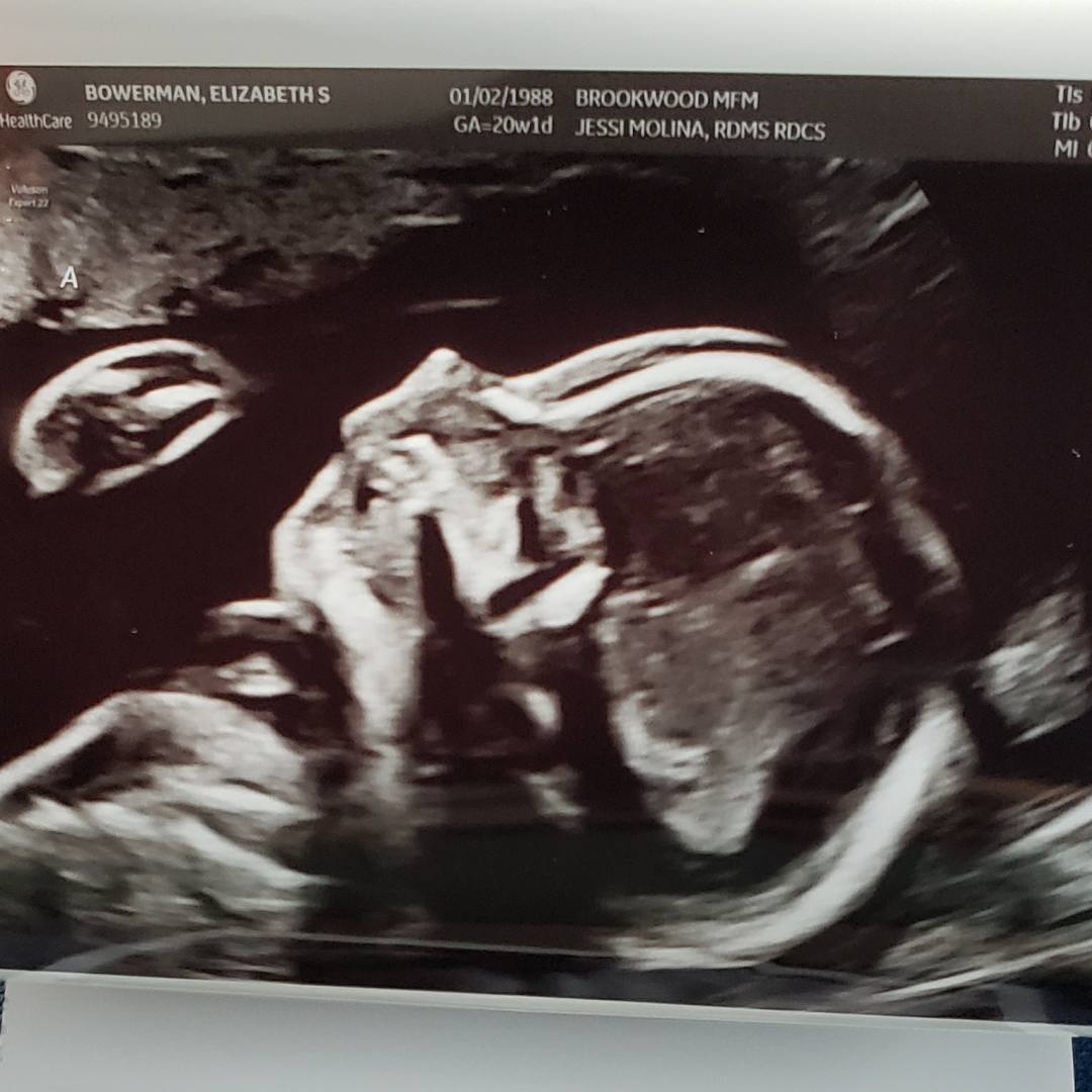 Photo shared by Sharee for their Babylist baby registry.