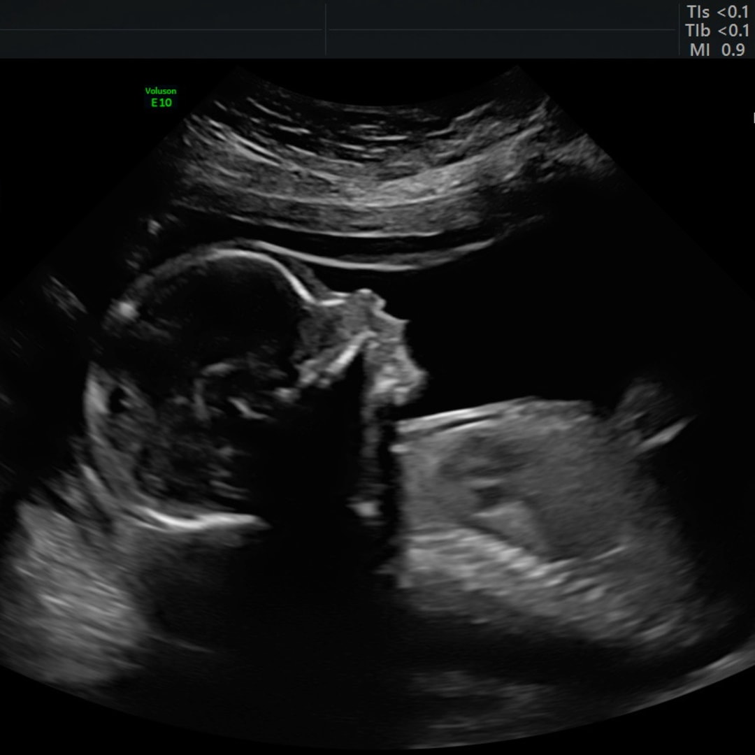 Photo shared by Emily for their Babylist baby registry.