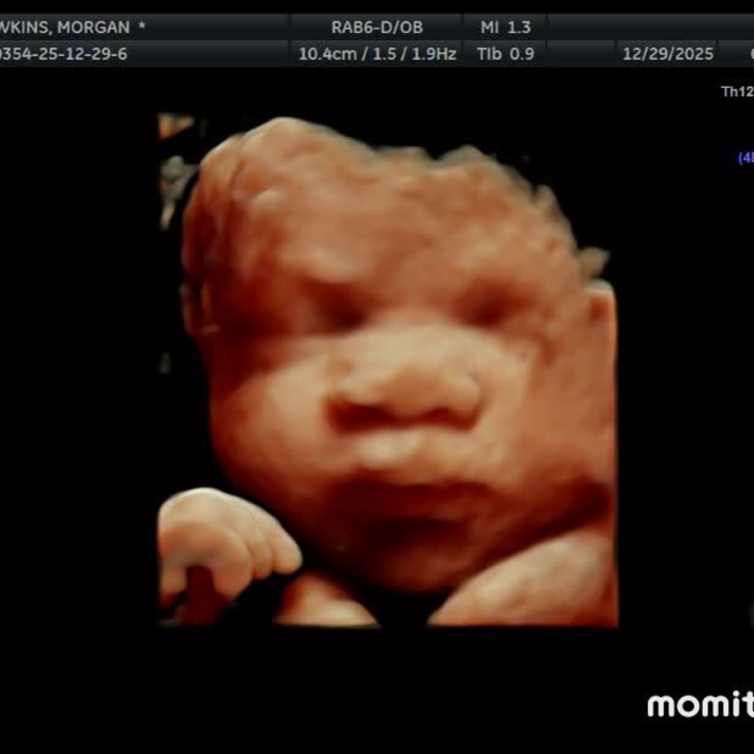 Photo shared by Morgan for their Babylist baby registry.