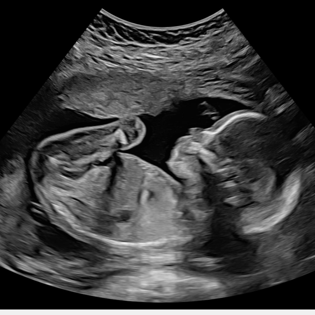 Photo shared by Shiloh for their Babylist baby registry.
