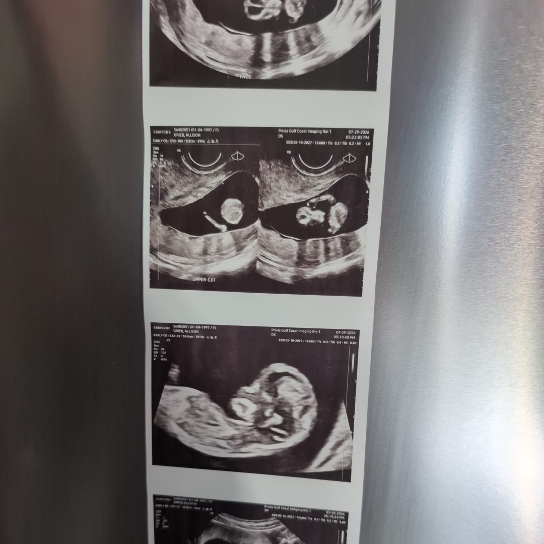 Photo shared by Allie for their Babylist baby registry.