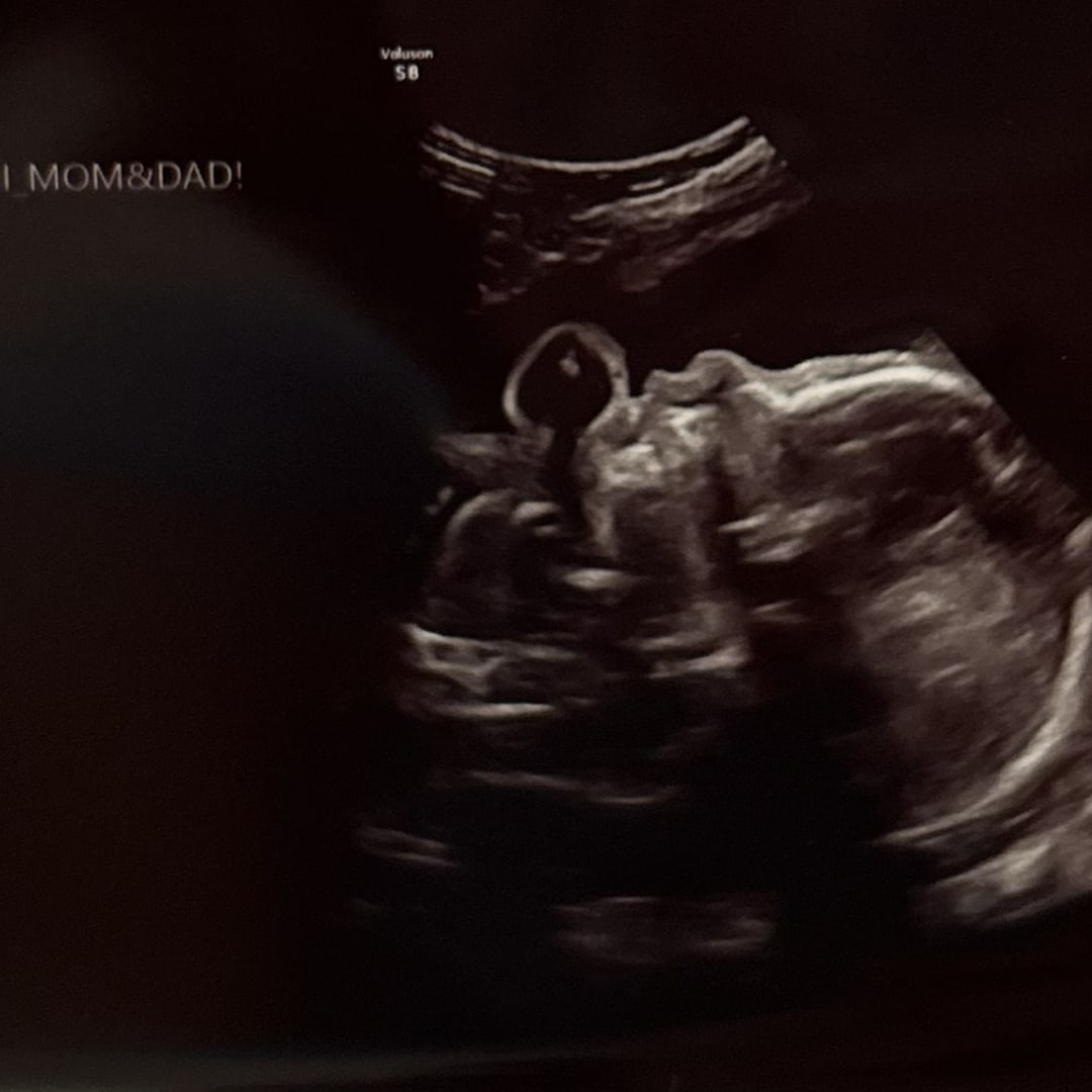 Photo shared by London for their Babylist baby registry.