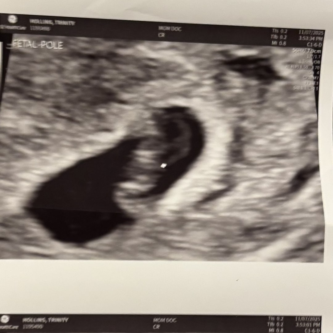 Photo shared by Trinity for their Babylist baby registry.