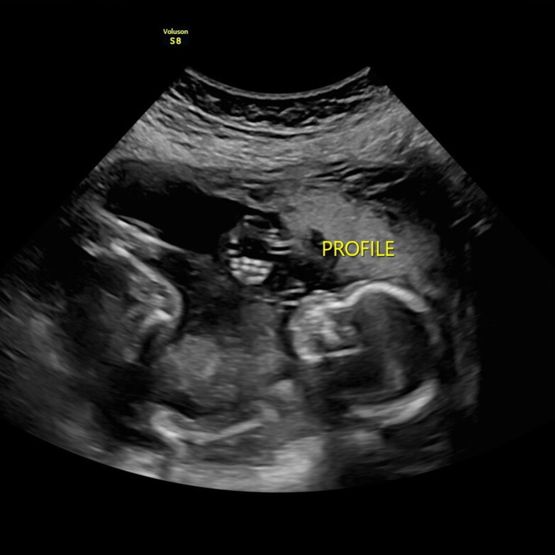 Photo shared by Emily for their Babylist baby registry.