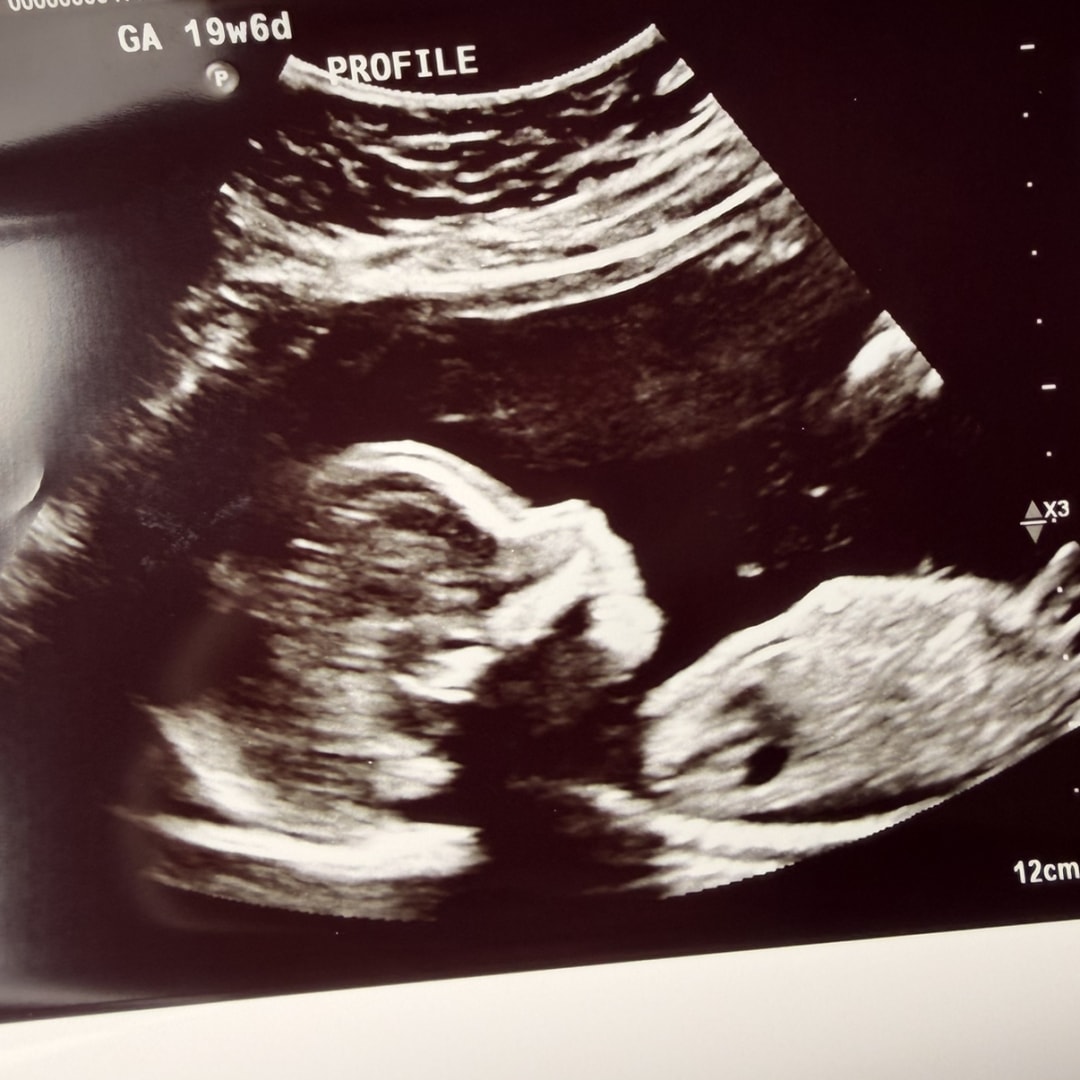 Photo shared by Jenna for their Babylist baby registry.