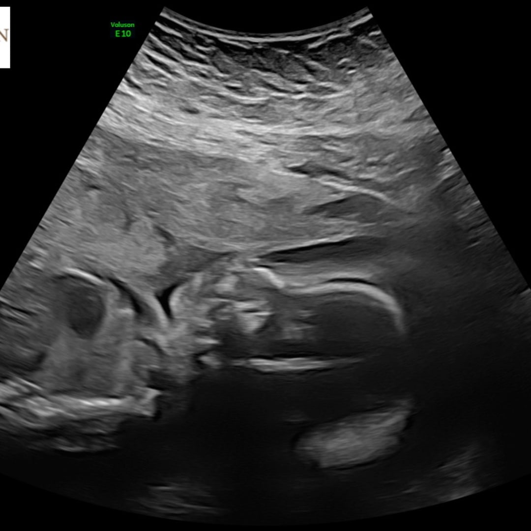 Photo shared by McKenna for their Babylist baby registry.