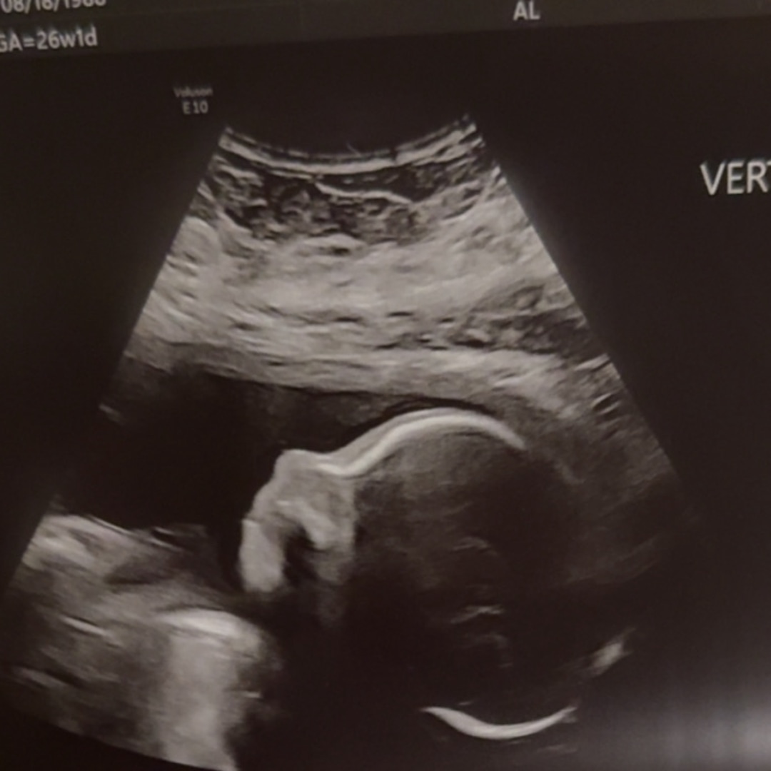 Photo shared by Beatriz for their Babylist baby registry.