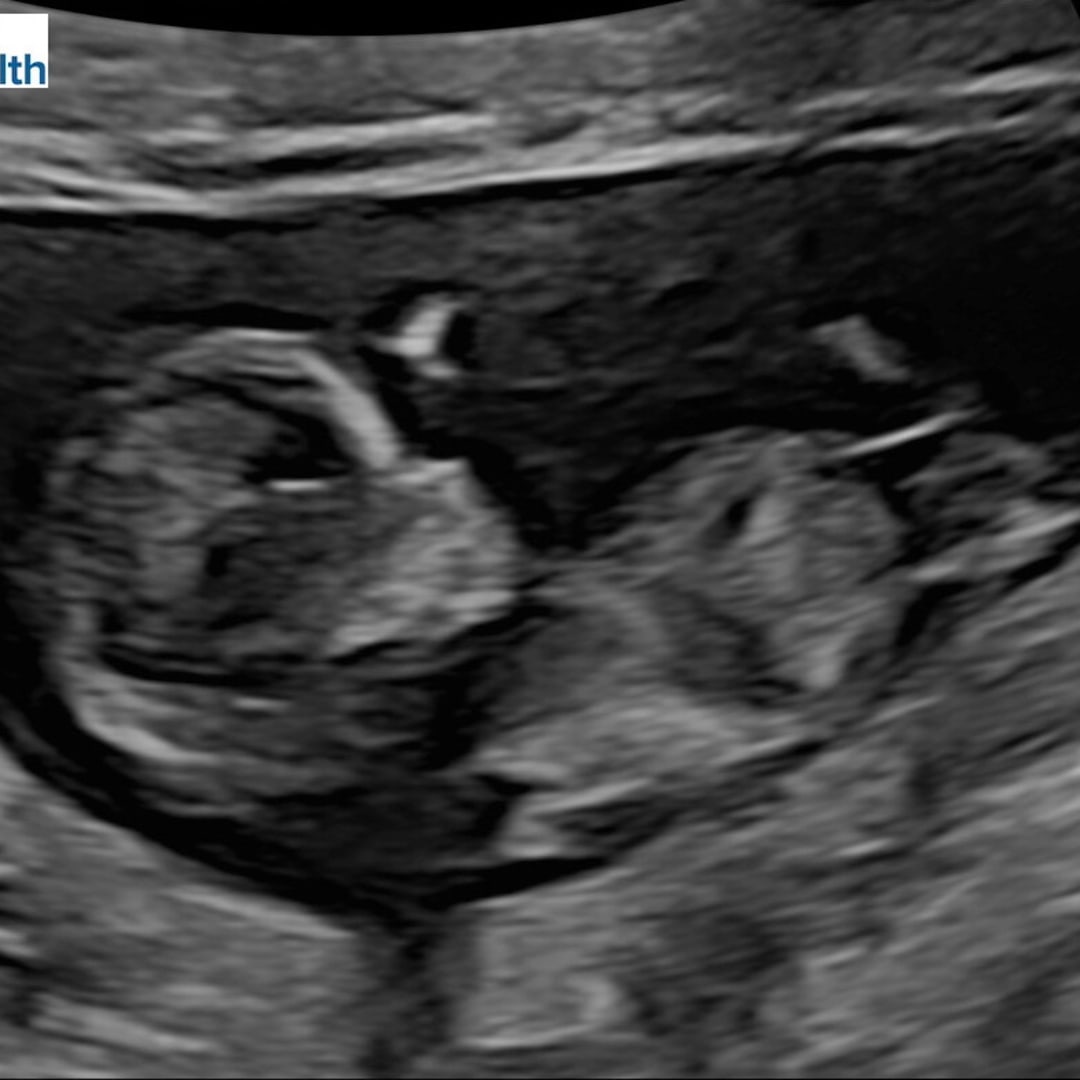 Photo shared by Brooke for their Babylist baby registry.