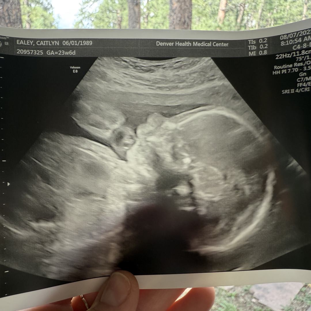 Photo shared by Caitlyn for their Babylist baby registry.