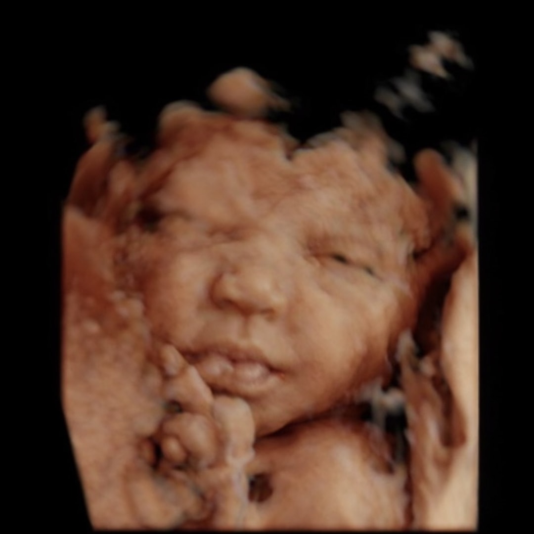 Photo shared by Treazure for their Babylist baby registry.