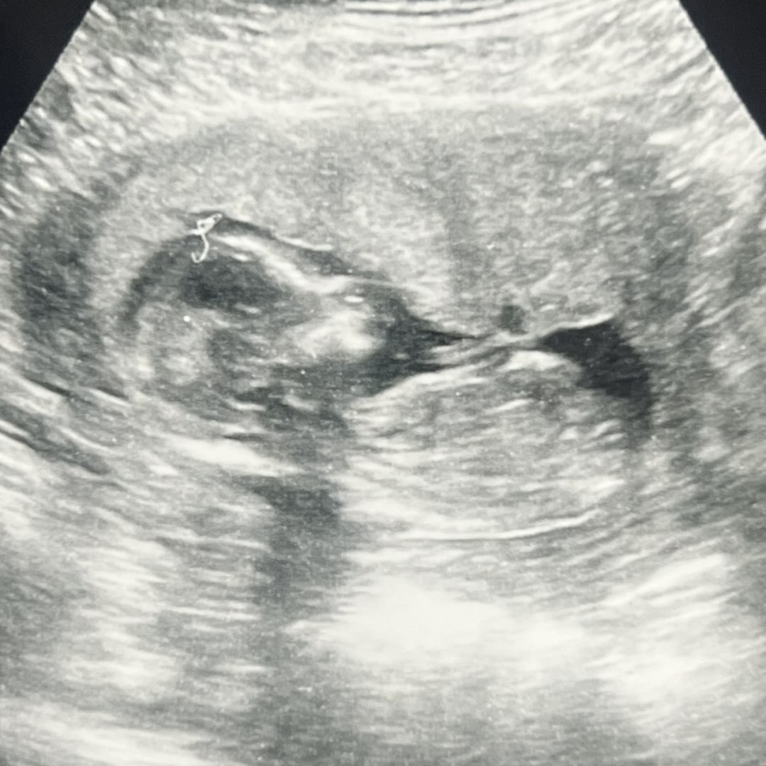 Photo shared by Megan for their Babylist baby registry.