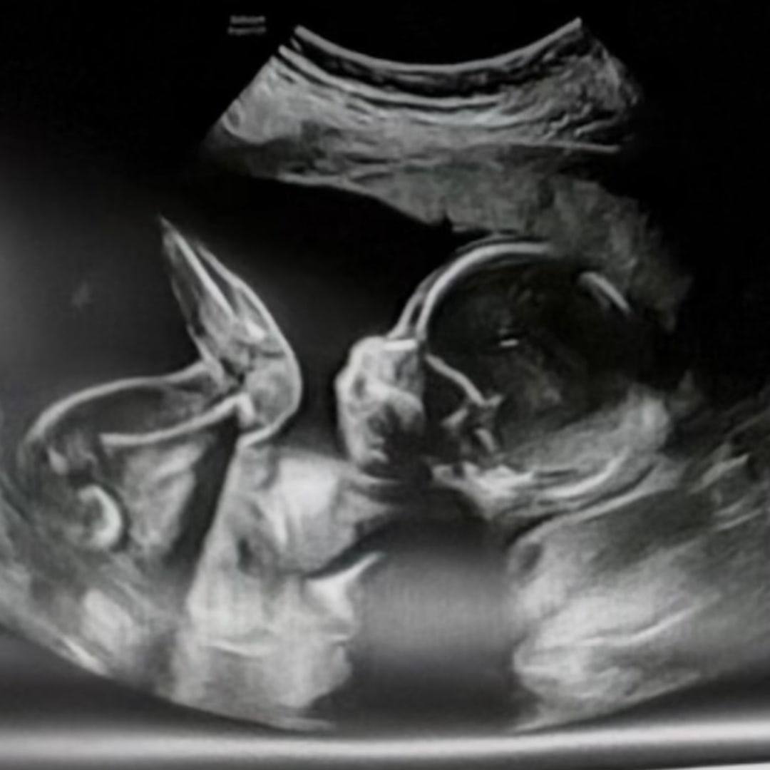 Photo shared by Vanessa for their Babylist baby registry.