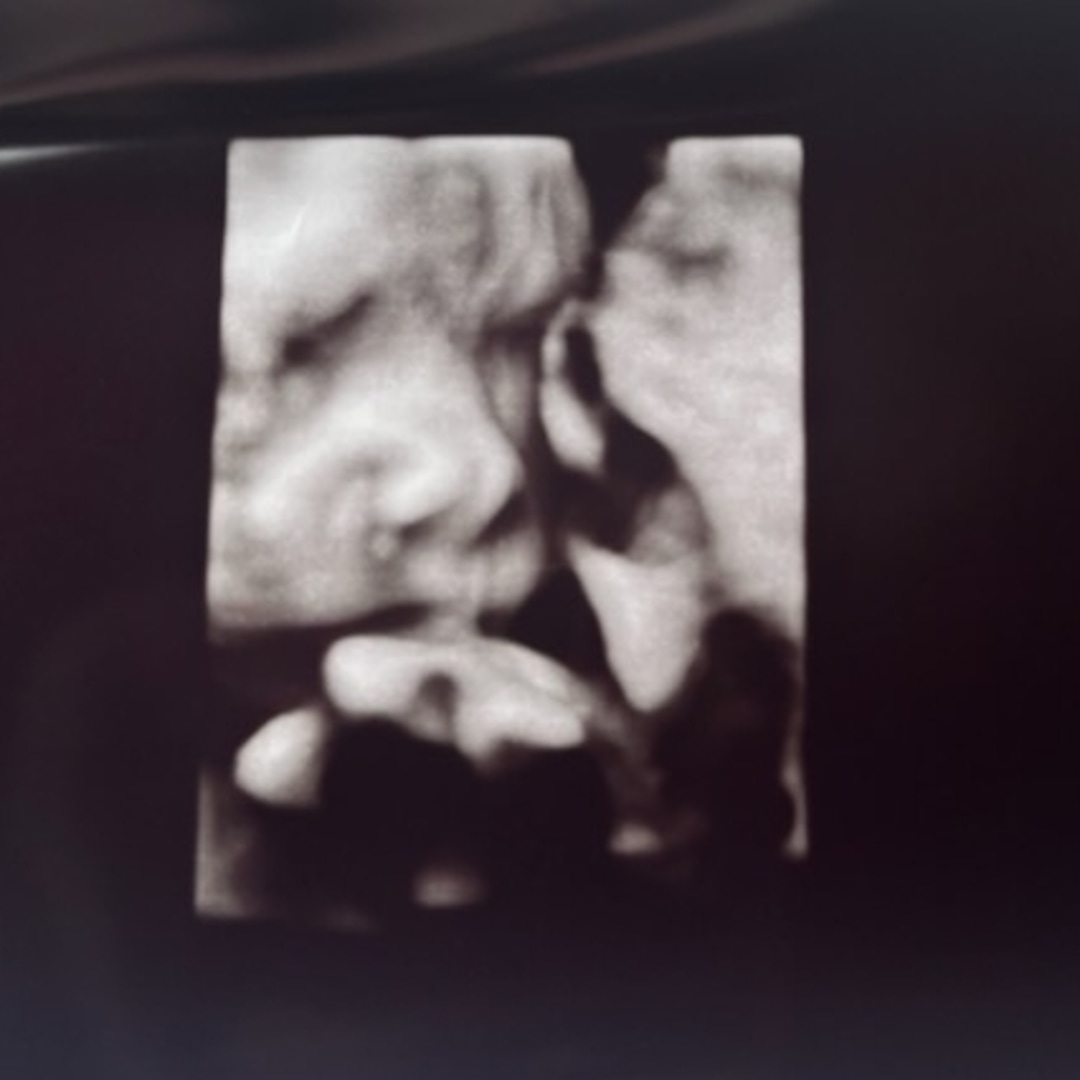 Photo shared by Aviona for their Babylist baby registry.
