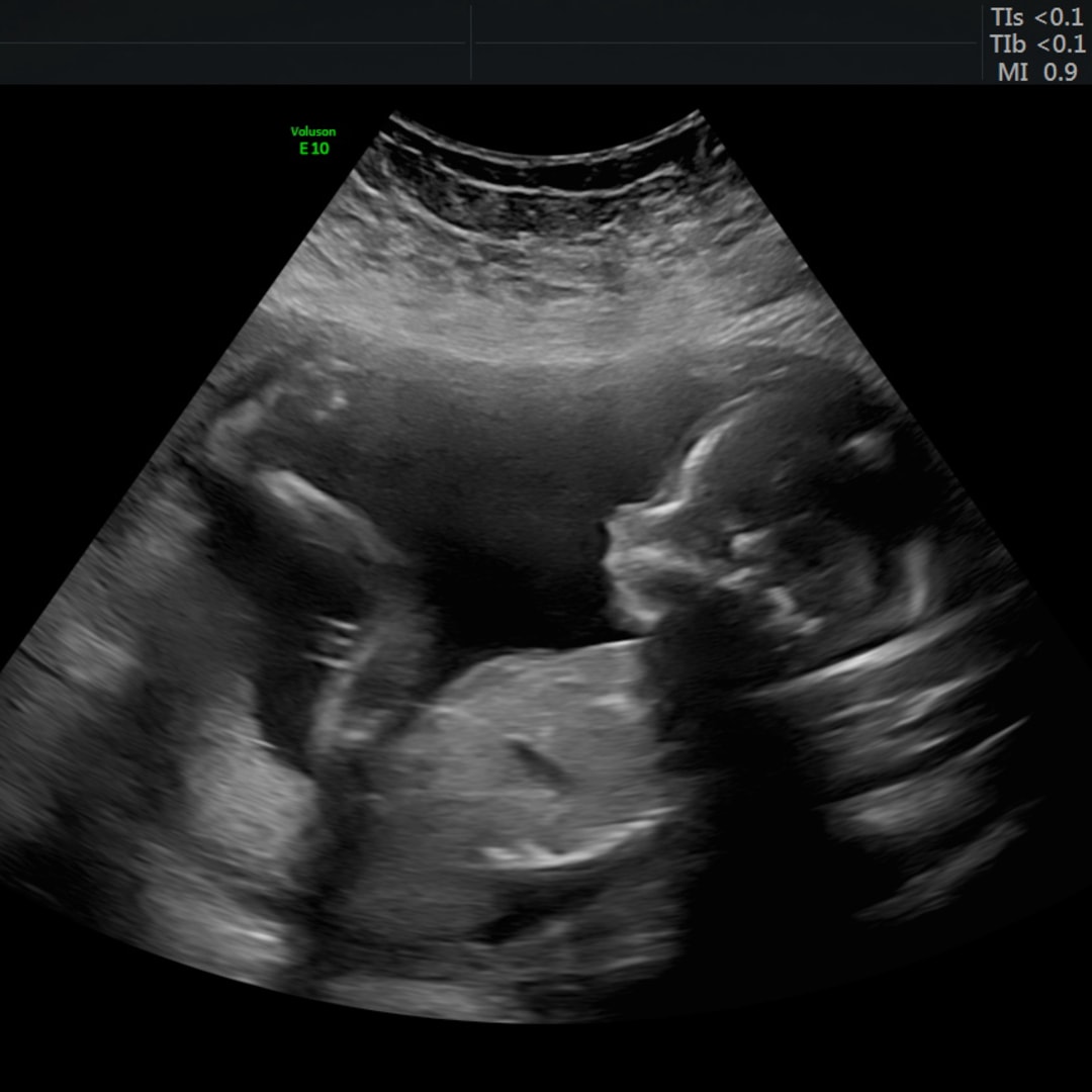 Photo shared by Erin for their Babylist baby registry.