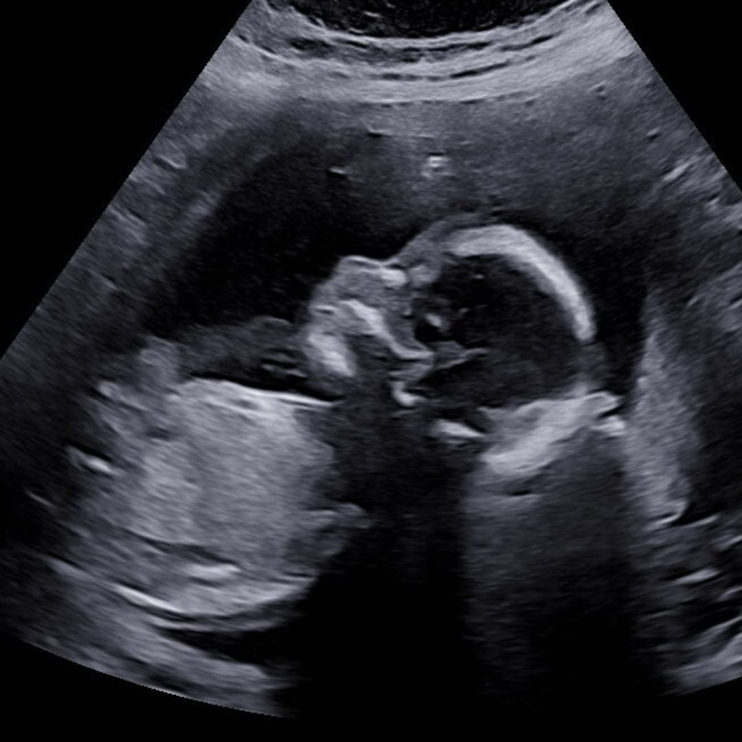 Photo shared by Kate for their Babylist baby registry.