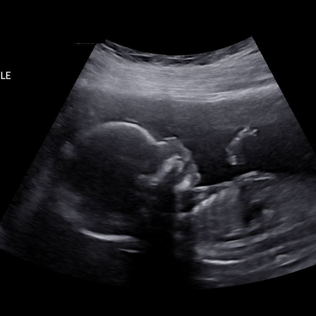 Photo shared by Becca for their Babylist baby registry.