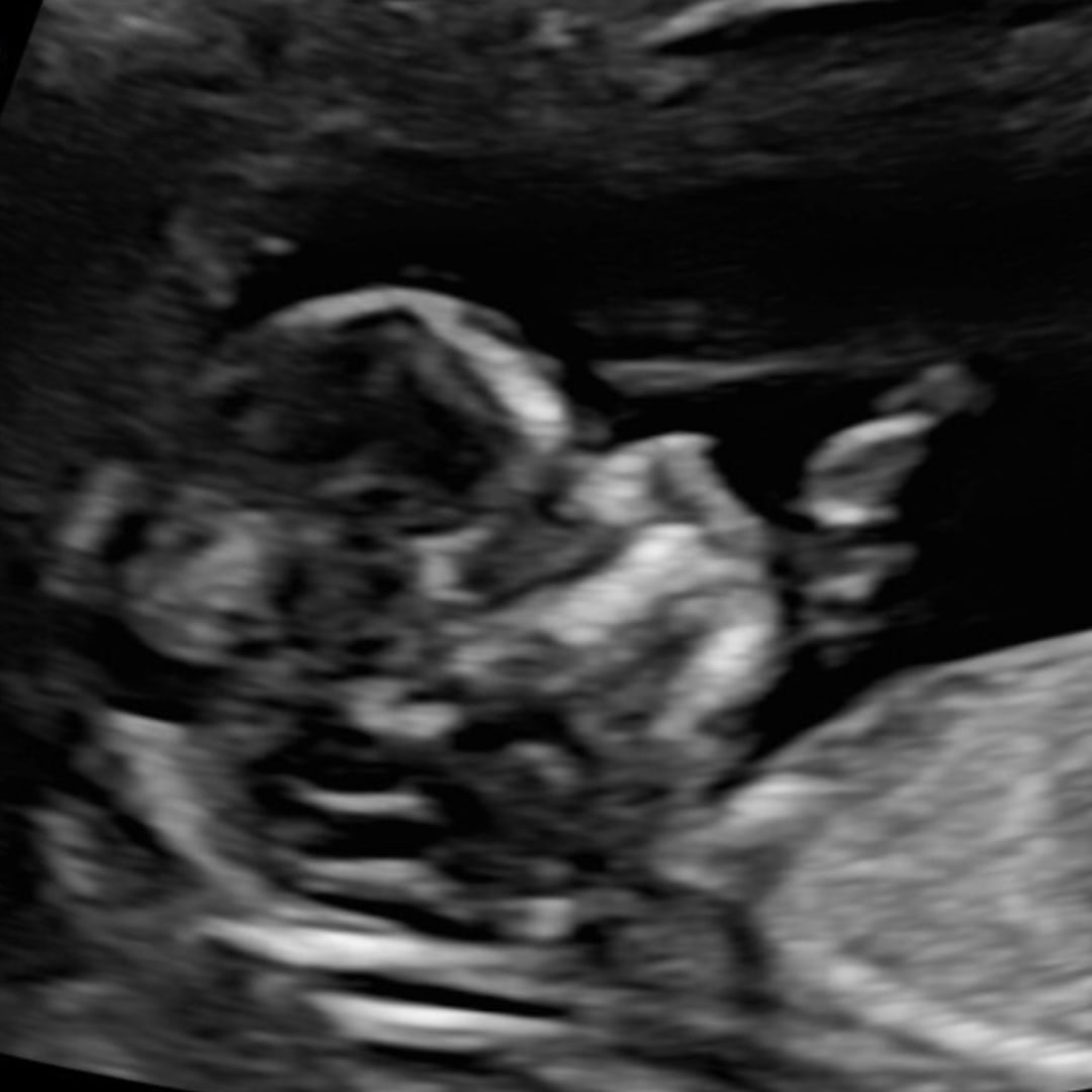 Photo shared by Christina for their Babylist baby registry.