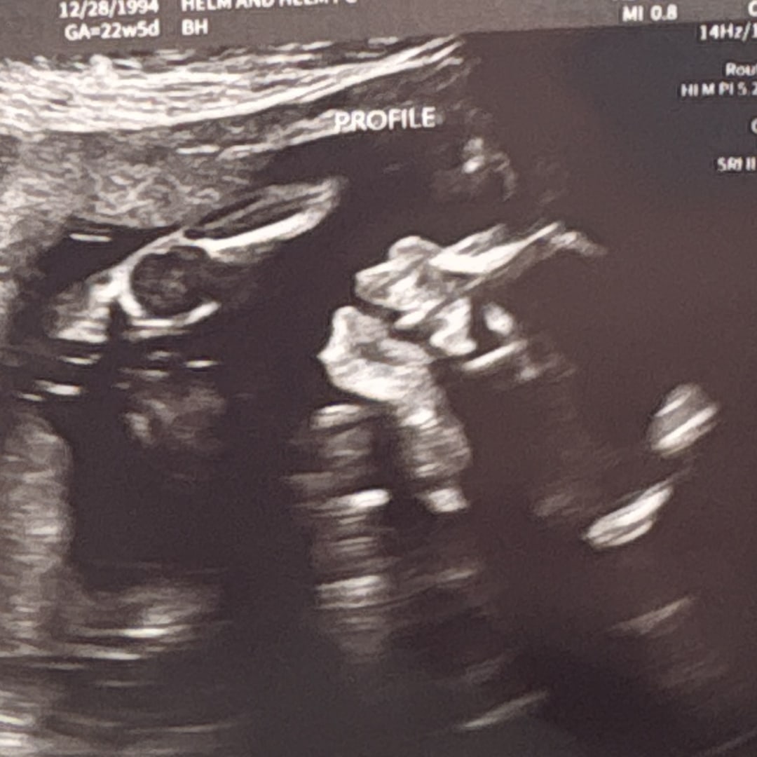 Photo shared by Briana for their Babylist baby registry.