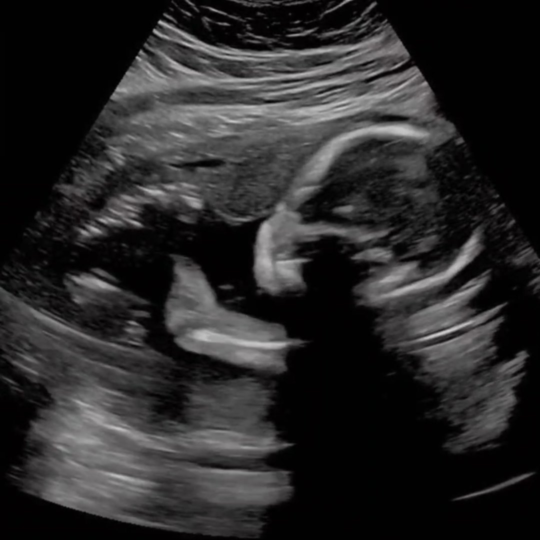 Photo shared by Ashley for their Babylist baby registry.