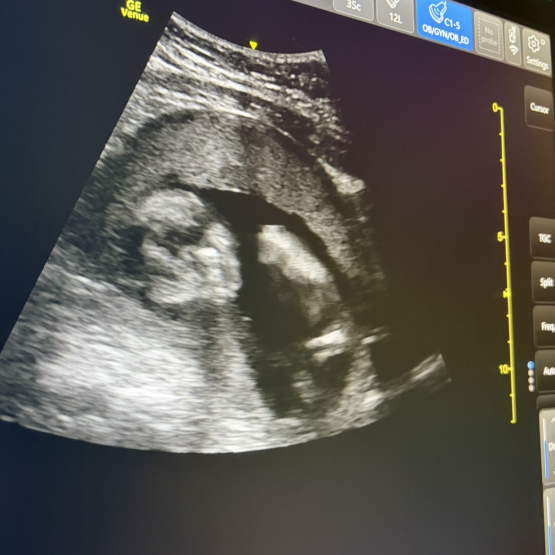 Photo shared by Emily for their Babylist baby registry.