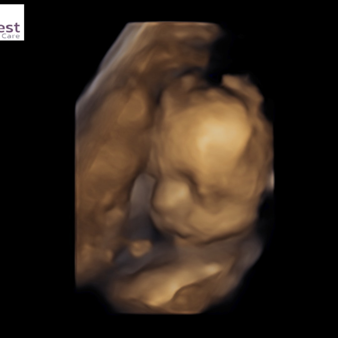 Photo shared by Cassie for their Babylist baby registry.