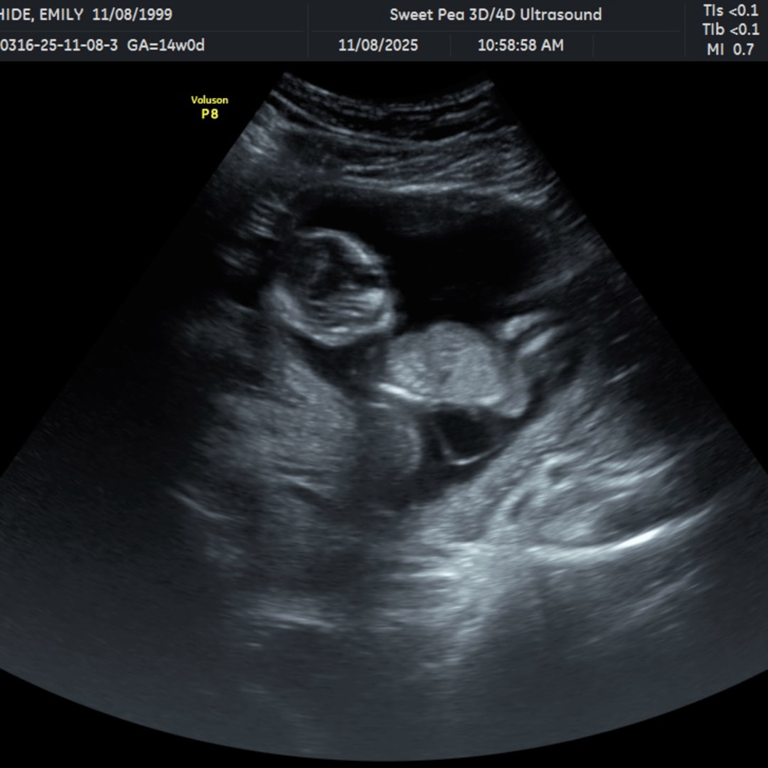 Photo shared by Emily for their Babylist baby registry.