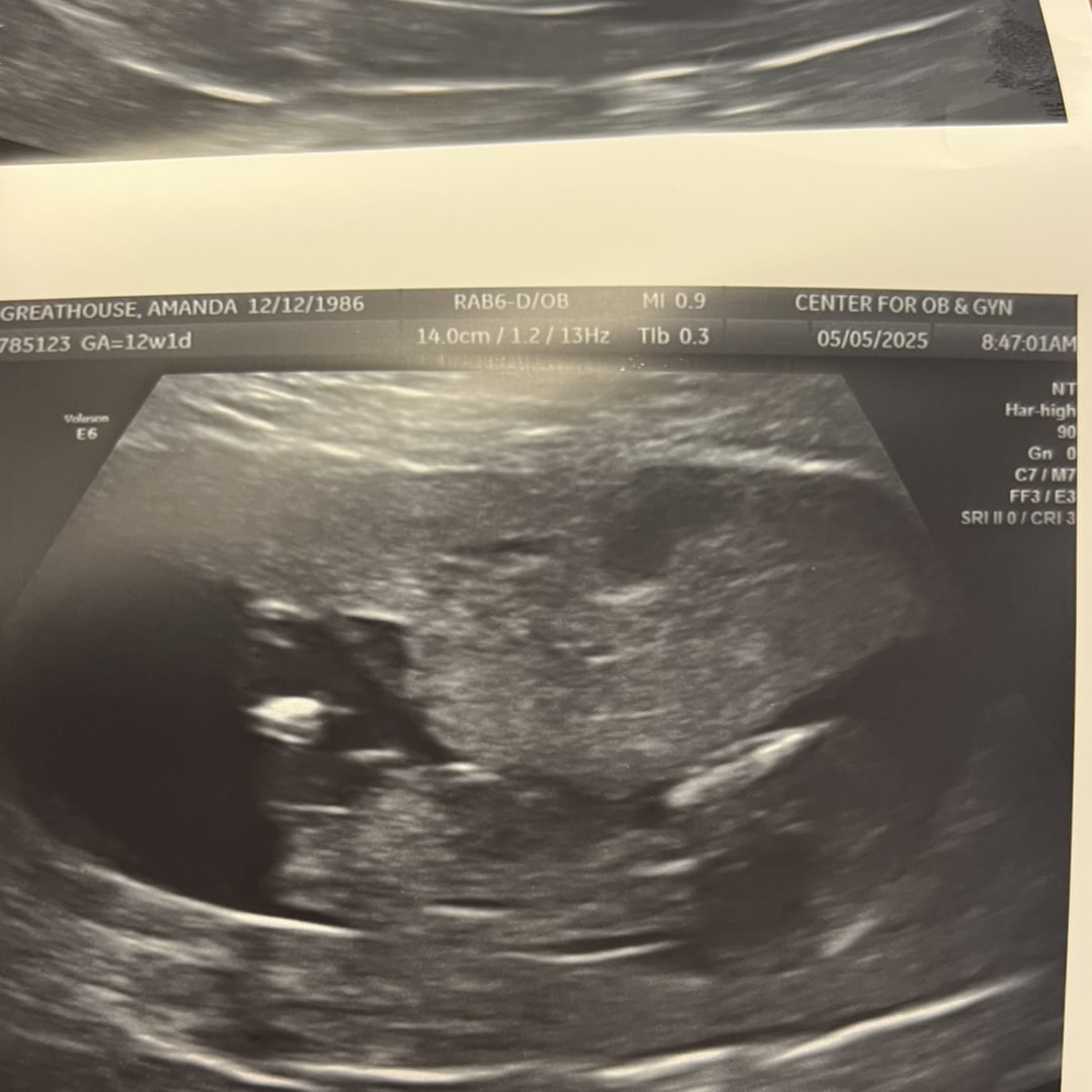 Photo shared by Amanda for their Babylist baby registry.